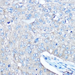 Invitrogen Seryl-tRNA synthetase Polyclonal Antibody 100 &mu;L; Unconjugated:Antibodies,