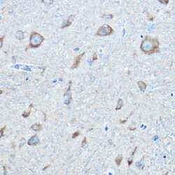 Invitrogen Seryl-tRNA synthetase Polyclonal Antibody 100 &mu;L; Unconjugated:Antibodies,