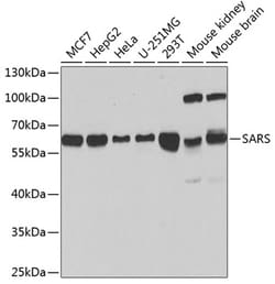 Invitrogen Seryl-tRNA synthetase Polyclonal Antibody 100 &mu;L; Unconjugated:Antibodies,