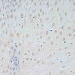 Invitrogen TCEB2 Polyclonal Antibody 100 &mu;L; Unconjugated:Antibodies,