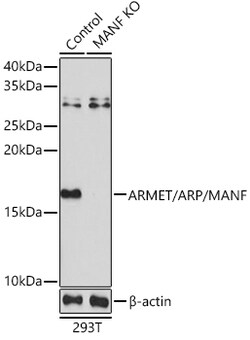 Invitrogen ARMET Polyclonal Antibody 100 &mu;L; Unconjugated:Antibodies,
