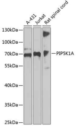 Invitrogen PIP5K1A Polyclonal Antibody 100 &mu;L; Unconjugated:Antibodies,