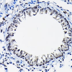 Invitrogen SSNA1 Polyclonal Antibody 100 &mu;L; Unconjugated:Antibodies,