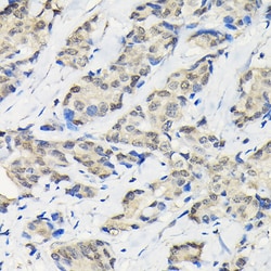 Invitrogen SSNA1 Polyclonal Antibody 100 &mu;L; Unconjugated:Antibodies,