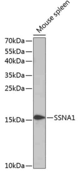 Invitrogen SSNA1 Polyclonal Antibody 100 &mu;L; Unconjugated:Antibodies,