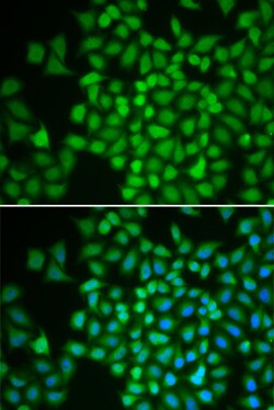Invitrogen JAB1 Polyclonal Antibody 100 &mu;L | Buy Online | Invitrogen&trade; | Fisher Scientific