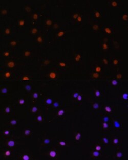 Invitrogen JAB1 Polyclonal Antibody 100 &mu;L | Buy Online | Invitrogen&trade; | Fisher Scientific