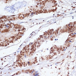 Invitrogen MNAR Polyclonal Antibody 100 &mu;L; Unconjugated:Antibodies,