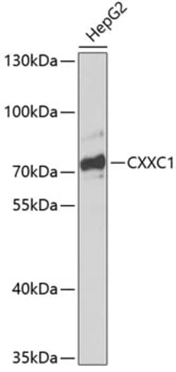 CGBP Polyclonal Antibody, Invitrogen 100 &mu;L; Unconjugated:Antibodies,