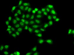 Invitrogen PHF11 Polyclonal Antibody 100 &mu;L; Unconjugated:Antibodies,