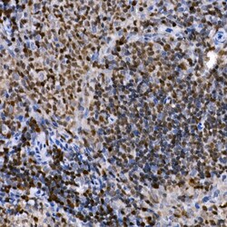 Invitrogen PHF11 Polyclonal Antibody 100 &mu;L; Unconjugated:Antibodies,
