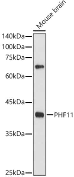 Invitrogen PHF11 Polyclonal Antibody 100 &mu;L; Unconjugated:Antibodies,