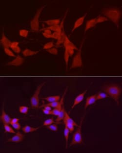 Invitrogen ADH5 Polyclonal Antibody 100 &mu;L; Unconjugated:Antibodies,