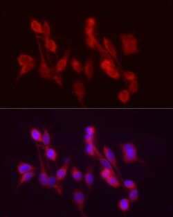 Invitrogen ADH5 Polyclonal Antibody 100 &mu;L; Unconjugated:Antibodies,