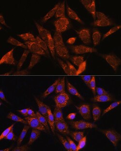 Invitrogen Angiogenin Polyclonal Antibody 100 &mu;L; Unconjugated:Antibodies,