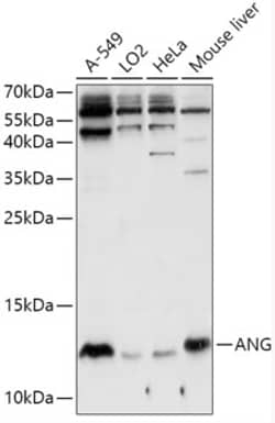 Invitrogen Angiogenin Polyclonal Antibody 100 &mu;L; Unconjugated:Antibodies,