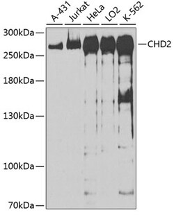 Invitrogen CHD2 Polyclonal Antibody 100 &mu;L; Unconjugated:Antibodies,