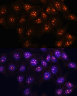 Invitrogen Fibrillarin Polyclonal Antibody 100 μL; Unconjugated:Antibodies,