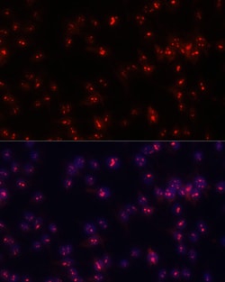 Invitrogen Fibrillarin Polyclonal Antibody 100 μL; Unconjugated:Antibodies,