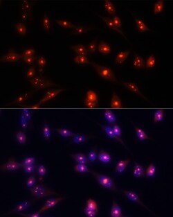 Invitrogen Fibrillarin Polyclonal Antibody 100 μL; Unconjugated:Antibodies,
