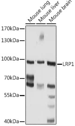 Invitrogen CD91 Polyclonal Antibody 100 &mu;L | Buy Online | Invitrogen&trade; | Fisher Scientific