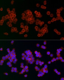 Invitrogen Lysozyme Polyclonal Antibody 100 &mu;L; Unconjugated:Antibodies,