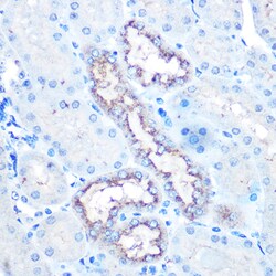 Invitrogen Lysozyme Polyclonal Antibody 100 &mu;L; Unconjugated:Antibodies,