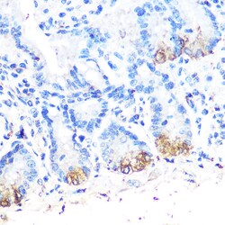 Invitrogen Lysozyme Polyclonal Antibody 100 &mu;L; Unconjugated:Antibodies,