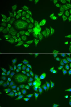 Invitrogen NDUFS4 Polyclonal Antibody 100 &mu;L; Unconjugated:Antibodies,