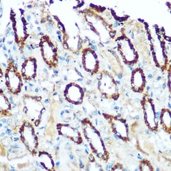 Invitrogen NDUFS4 Polyclonal Antibody 100 &mu;L; Unconjugated:Antibodies,