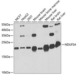 Invitrogen NDUFS4 Polyclonal Antibody 100 &mu;L; Unconjugated:Antibodies,
