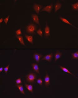Invitrogen COL1A1 Polyclonal Antibody 100 &mu;L | Buy Online | Invitrogen&trade; | Fisher Scientific
