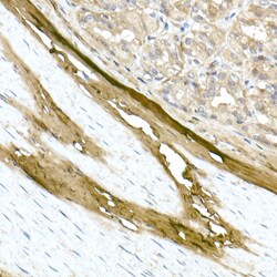 Invitrogen COL1A1 Polyclonal Antibody 100 &mu;L | Buy Online | Invitrogen&trade; | Fisher Scientific