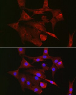 Invitrogen TFAM Polyclonal Antibody 100 &mu;L; Unconjugated:Antibodies,