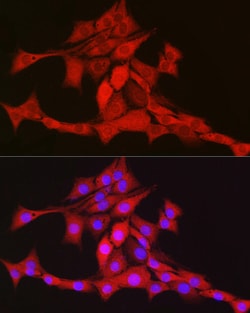 Invitrogen TFAM Polyclonal Antibody 100 &mu;L; Unconjugated:Antibodies,