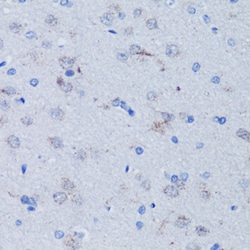 Invitrogen TFAM Polyclonal Antibody 100 &mu;L; Unconjugated:Antibodies,