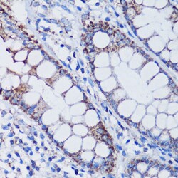 Invitrogen TFAM Polyclonal Antibody 100 &mu;L; Unconjugated:Antibodies,