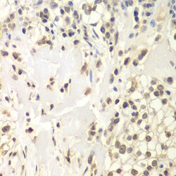 Invitrogen USP7 Polyclonal Antibody 100 &mu;L | Buy Online | Invitrogen&trade; | Fisher Scientific