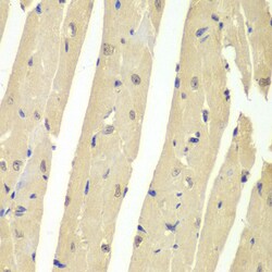 Invitrogen USP7 Polyclonal Antibody 100 &mu;L | Buy Online | Invitrogen&trade; | Fisher Scientific