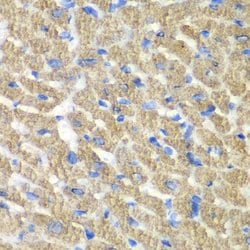 FIBP Polyclonal Antibody, Invitrogen 100 &mu;L; Unconjugated:Antibodies,