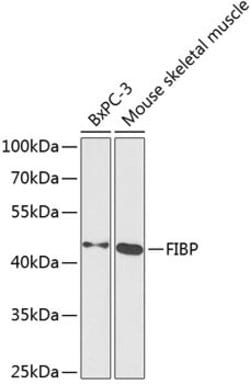 FIBP Polyclonal Antibody, Invitrogen 100 &mu;L; Unconjugated:Antibodies,