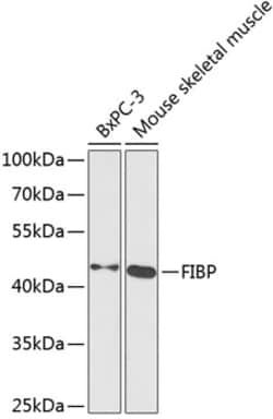 FIBP Polyclonal Antibody, Invitrogen 100 &mu;L; Unconjugated:Antibodies,