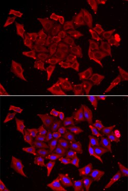TIM17 Polyclonal Antibody, Invitrogen 100 &mu;L; Unconjugated:Antibodies,