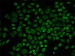 Invitrogen RAD54L2 Polyclonal Antibody 100 &mu;L; Unconjugated:Antibodies,