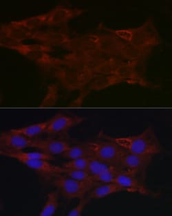 Invitrogen UGT1A1 Polyclonal Antibody 100 &mu;L; Unconjugated:Antibodies,