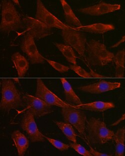 Invitrogen UGT1A1 Polyclonal Antibody 100 &mu;L; Unconjugated:Antibodies,