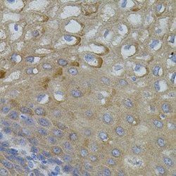 Invitrogen MFN2 Polyclonal Antibody 100 &mu;L; Unconjugated:Antibodies,