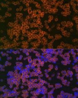 Invitrogen CD38 Polyclonal Antibody 100 &mu;L; Unconjugated:Antibodies,