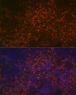 Invitrogen CD38 Polyclonal Antibody 100 &mu;L; Unconjugated:Antibodies,