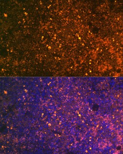 Invitrogen CD38 Polyclonal Antibody 100 &mu;L; Unconjugated:Antibodies,